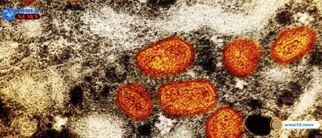 The antiviral Tecovirimat is safe but did not improve the resolution of Clade I Mpox in the Democratic Republic of the Congo.
